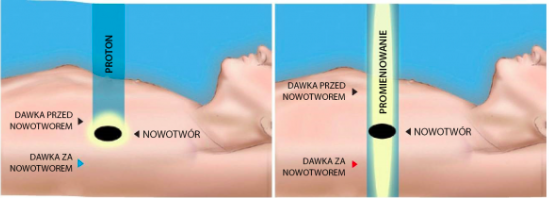 protony wiązka